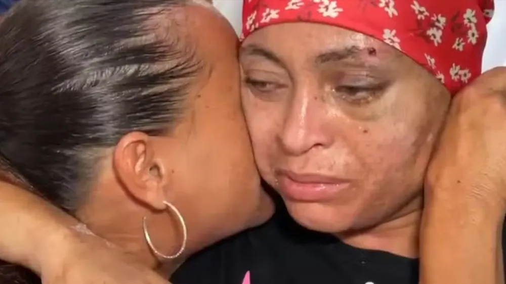 Fernanda recebeu alta do hospital em Bauru após 19 dias internada — Foto: Marcelo Risso/ TV TEM